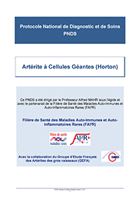 pnds arterite a cellules geantes