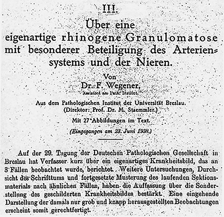 04 gw