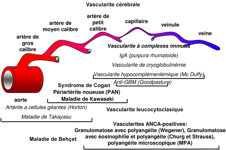 classification