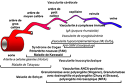 Classification::vascularites classification mini