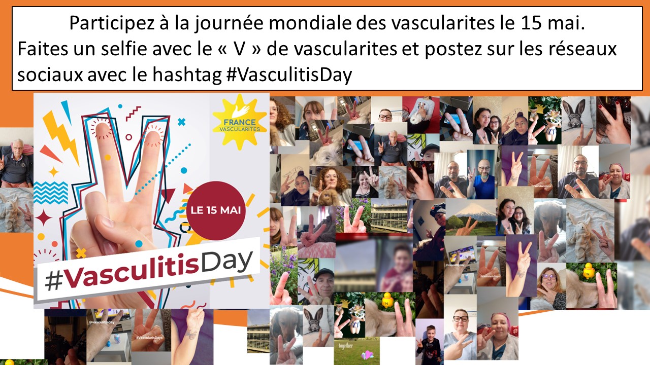 Présentation1