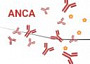 anca