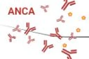 anca